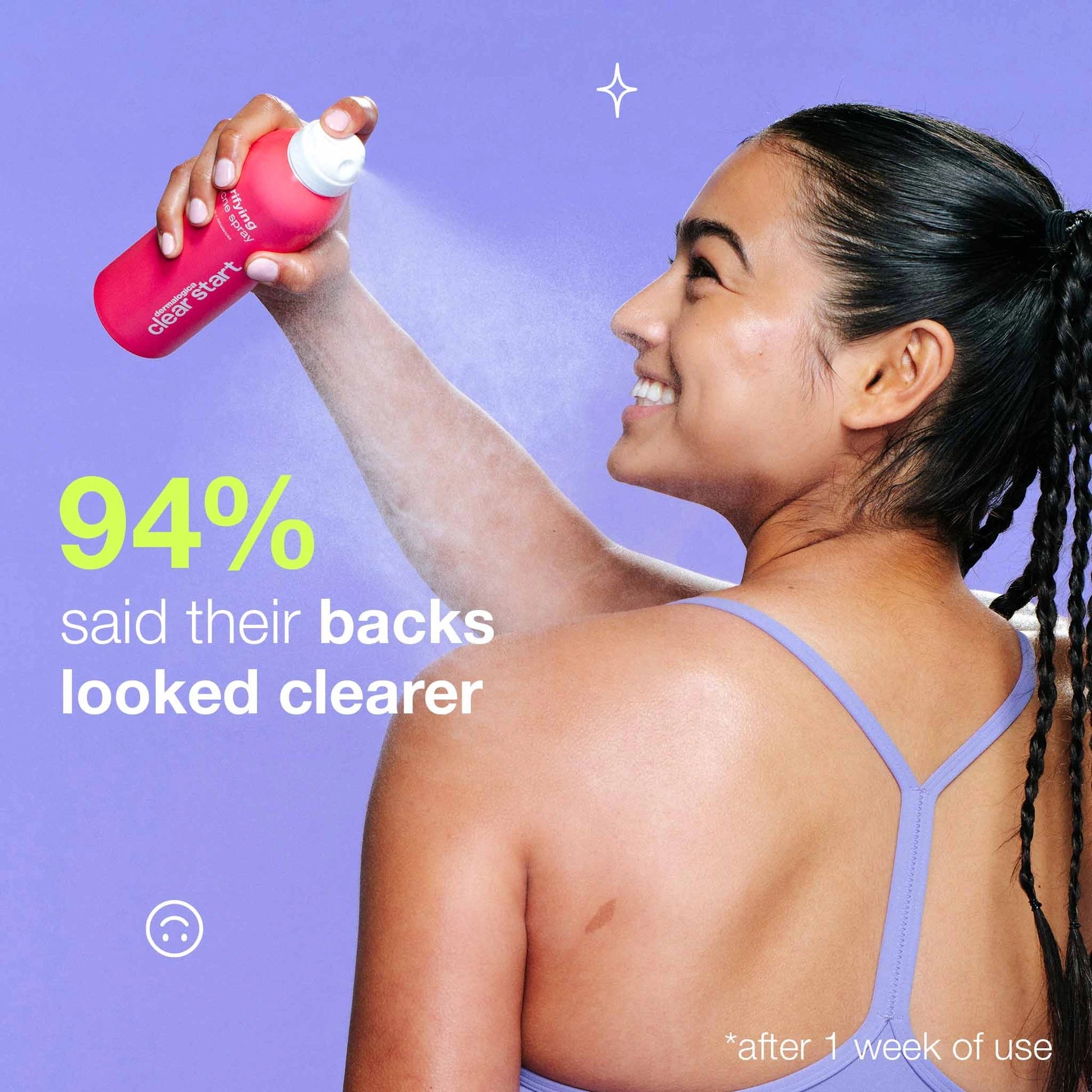Dermalogica Clarifying Body Spray 177ml being used, showcasing clear skin and effective acne treatment results.