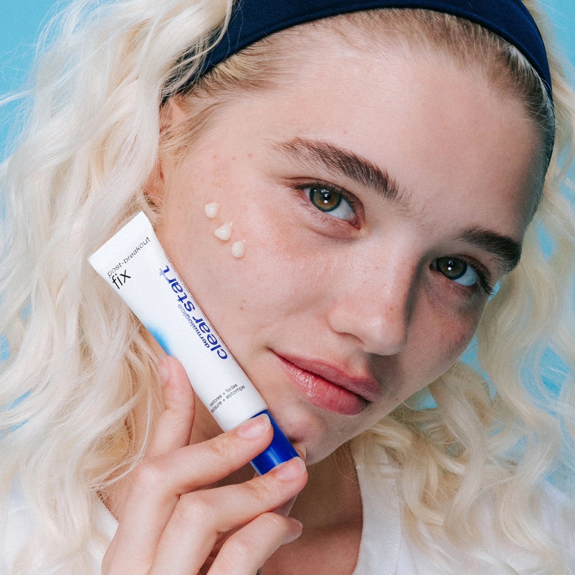 Dermalogica Post-Breakout Fix 15ml met crème op de huid van een model voor het verminderen van donkere vlekjes