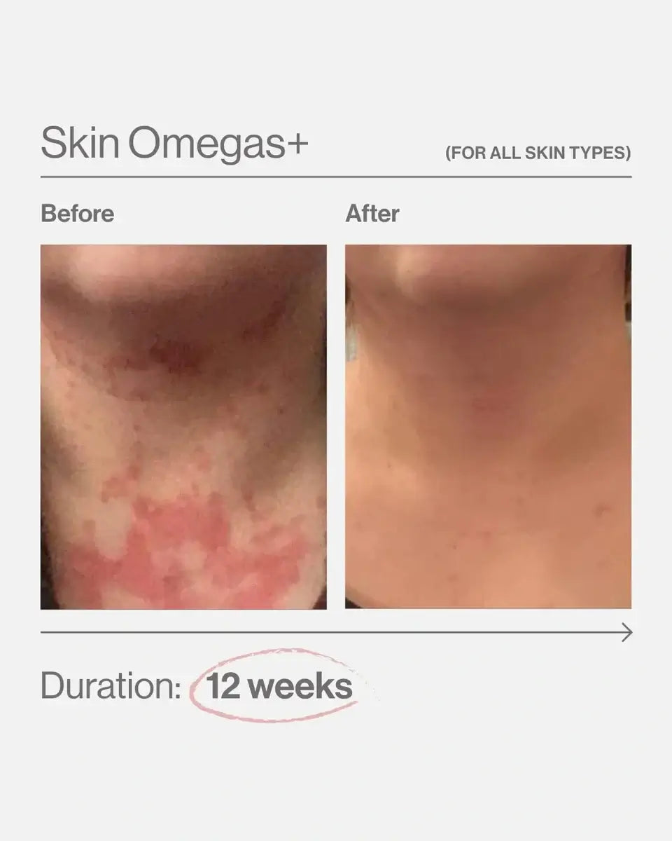 Skin Omegas+ Advanced Nutrition Programme 180 caps