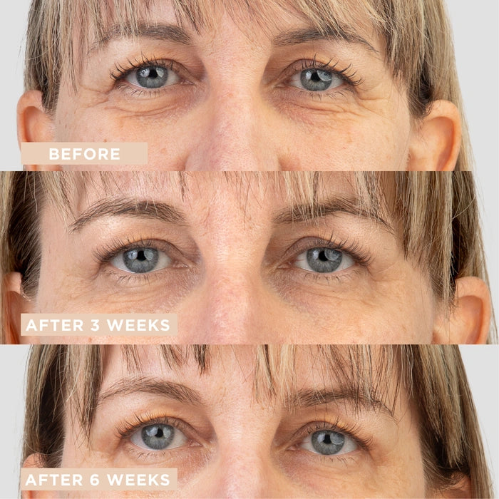 LYCON Skin Eye Lifting Gel-Crème Serum 15ml voor en na gebruik: huidverbetering zichtbaar na 3 en 6 weken.