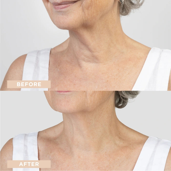 LYCON Skin Neck + Décolleté Firming Cream 50ml