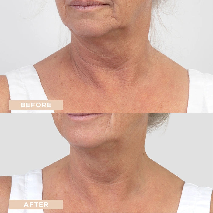 LYCON Skin Revitalising Hyaluronic + B5 Booster Serum 30ml voor en na resultaten met verbeterde huidstructuur en hydratatie.