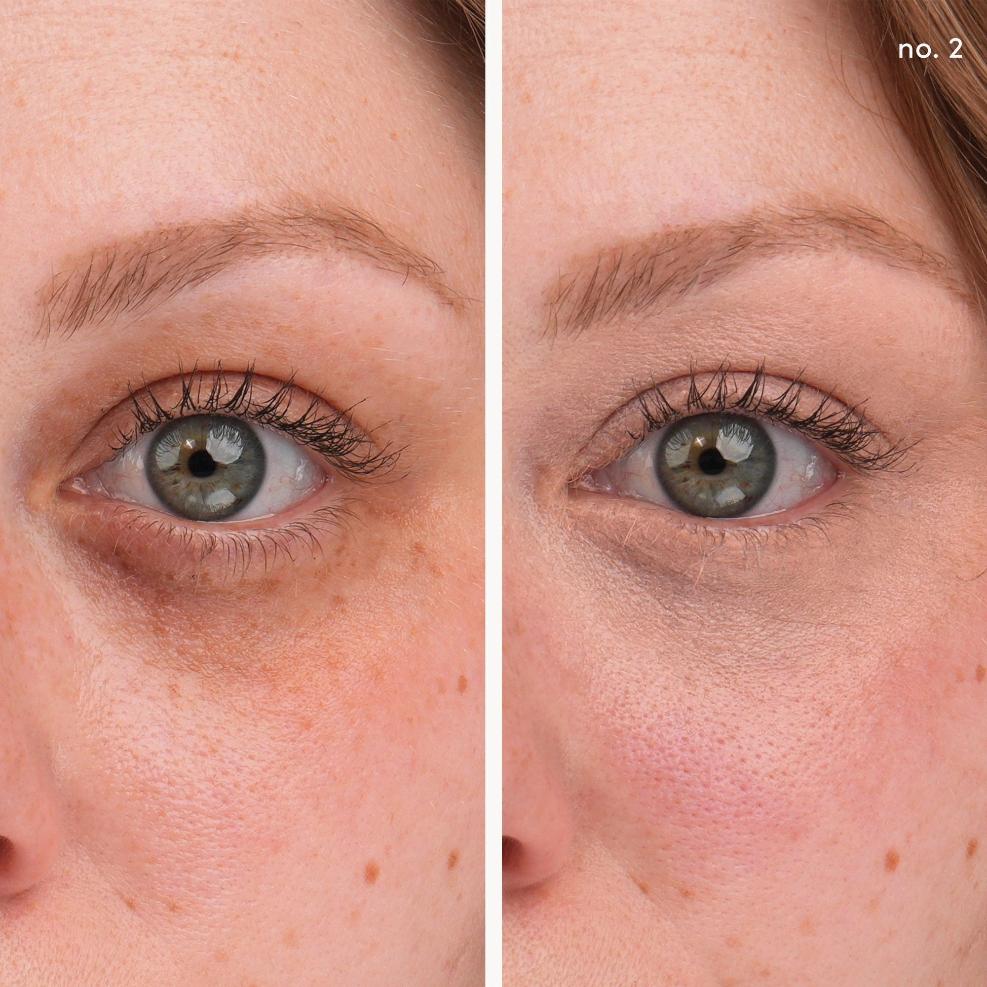 Jane Iredale Circle Delete Concealer 2 2,8g resultaat voor donkere kringen onder ogen, voor en na gebruik