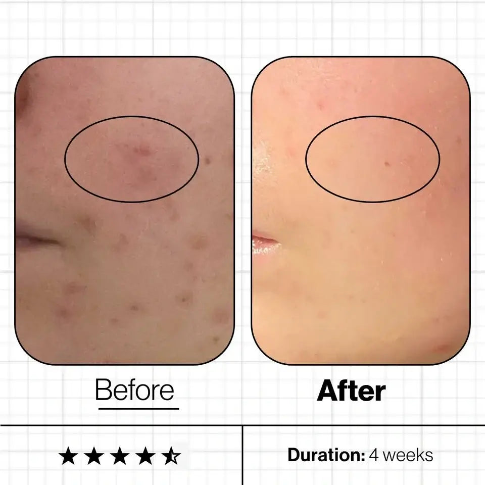 Skin Clear Biome Advanced Nutrition Programme 60 caps