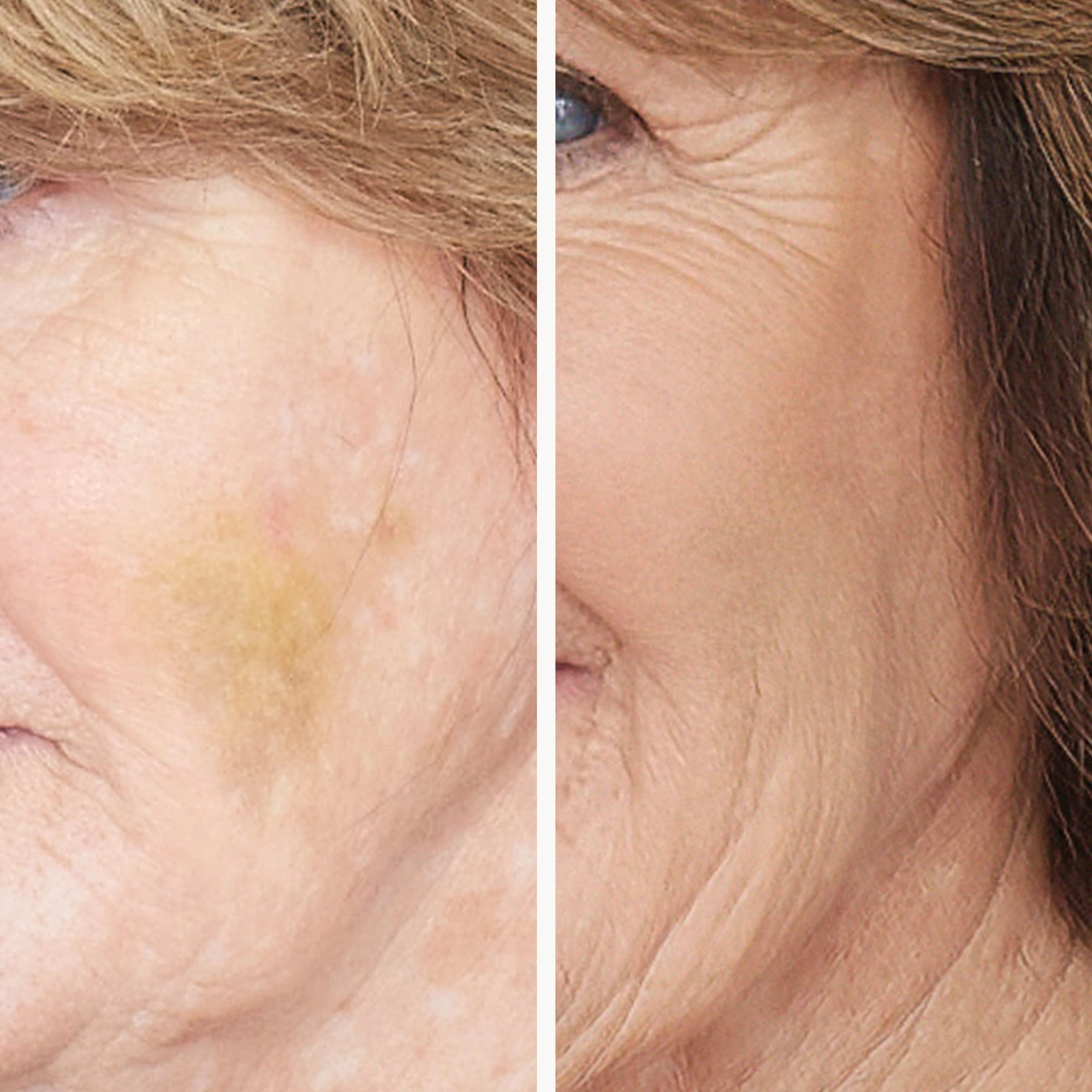 Jane Iredale Corrective Colors 9,9g voor het camoufleren van hyperpigmentatie en blauwe plekken, voor en na toepassing.