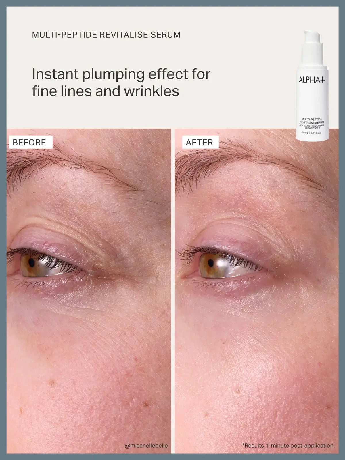 Alpha-H Multi-Peptide Revitalise Serum 30ml before and after showing instant plumping effect for fine lines and wrinkles.
