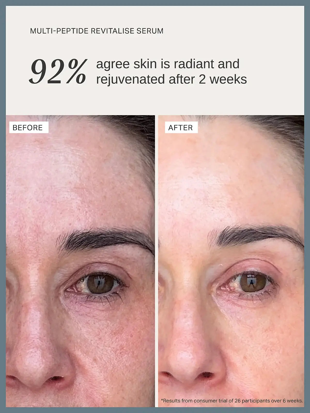 Alpha-H Multi-Peptide Revitalise Serum 30ml before and after results showing radiant skin.