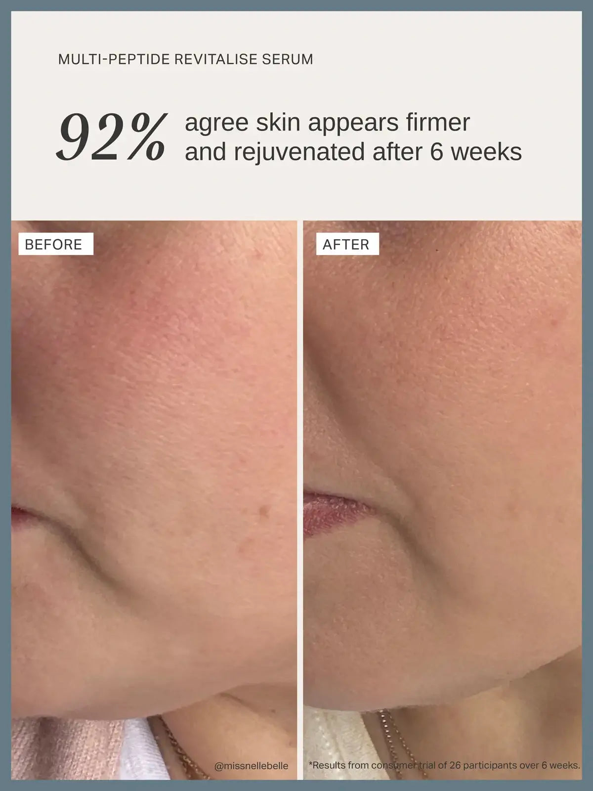 Alpha-H Multi-Peptide Revitalise Serum 30ml effectiveness shown in skin results before and after 6 weeks.