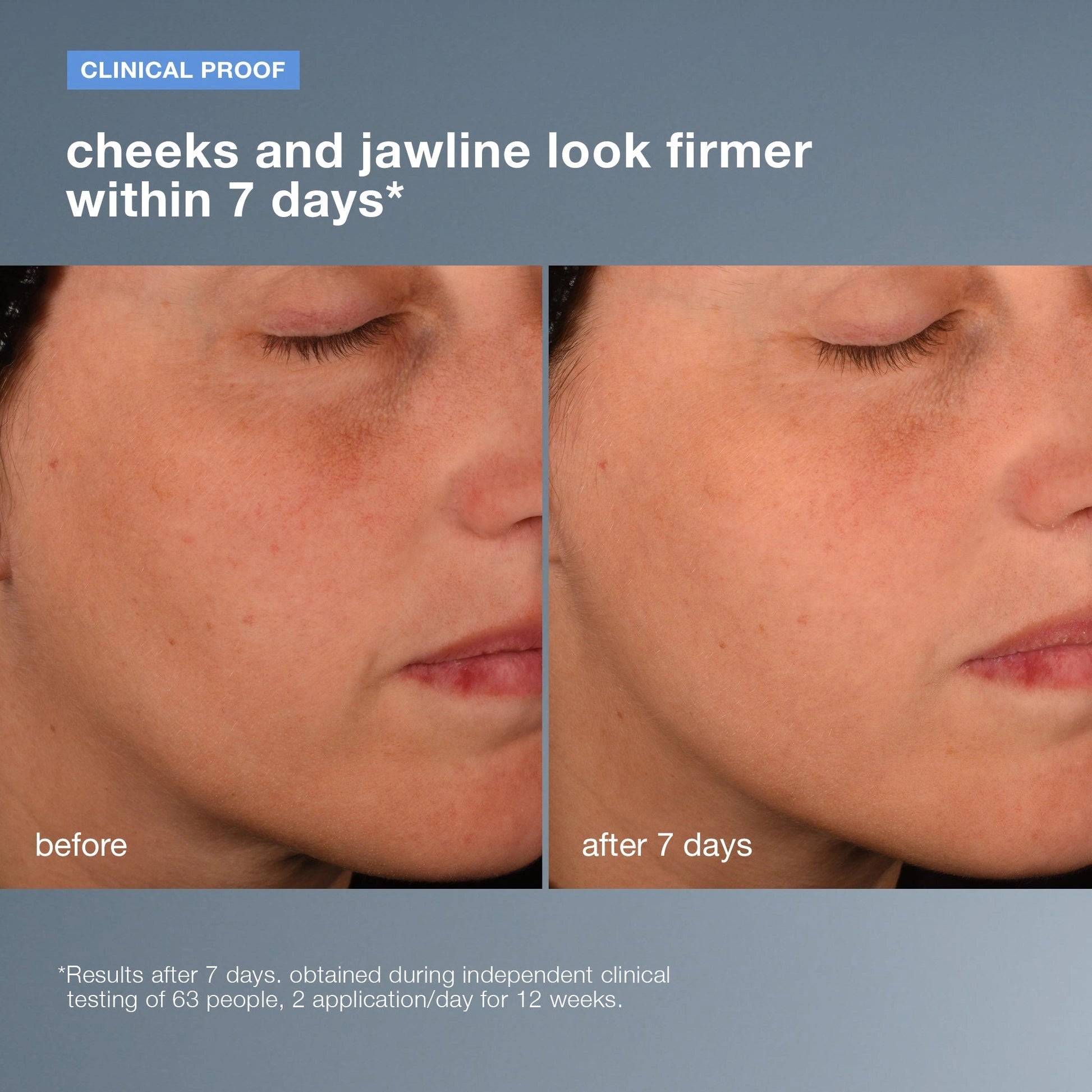 Dermalogica Pro-Collagen Banking Serum 30ml resultaat voor en na, steviger gezicht binnen 7 dagen, klinisch bewijs