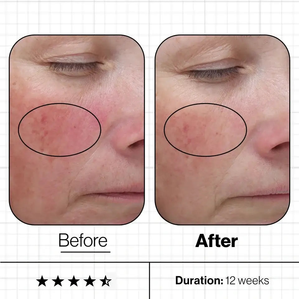 Skin Even IQ Advanced Nutrition Progamme 28x 5 caps