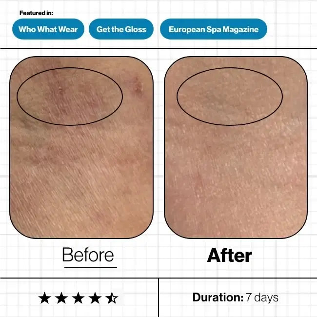 Skin Moisture IQ Advanced Nutrition Programme 28x 5 caps