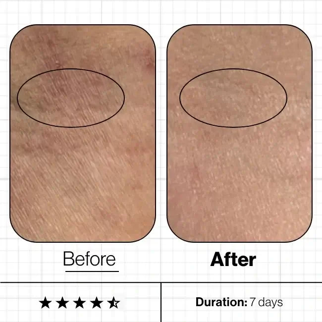 Skin Moisture IQ Advanced Nutrition Programme 28x 5 caps