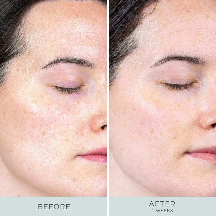 PUR Ceretin Boost Age Defying Retinol Serum 30ml voor en na resultaten, zichtbaar verbeterde huidtextuur en teint na 4 weken.