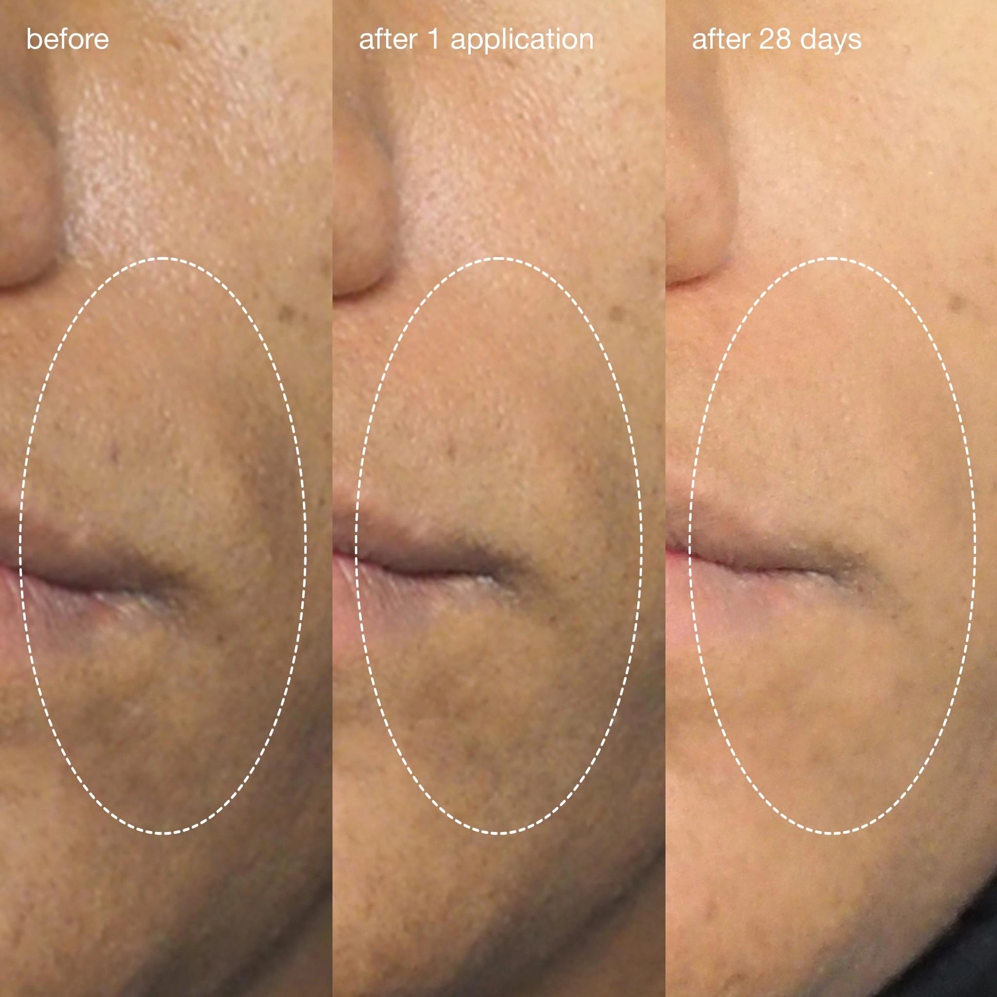 Dermalogica Liquid Peelfoliant 59ml voor en na resultaten, zichtbaar verbeterde huidtextuur na 1 toepassing en na 28 dagen.
