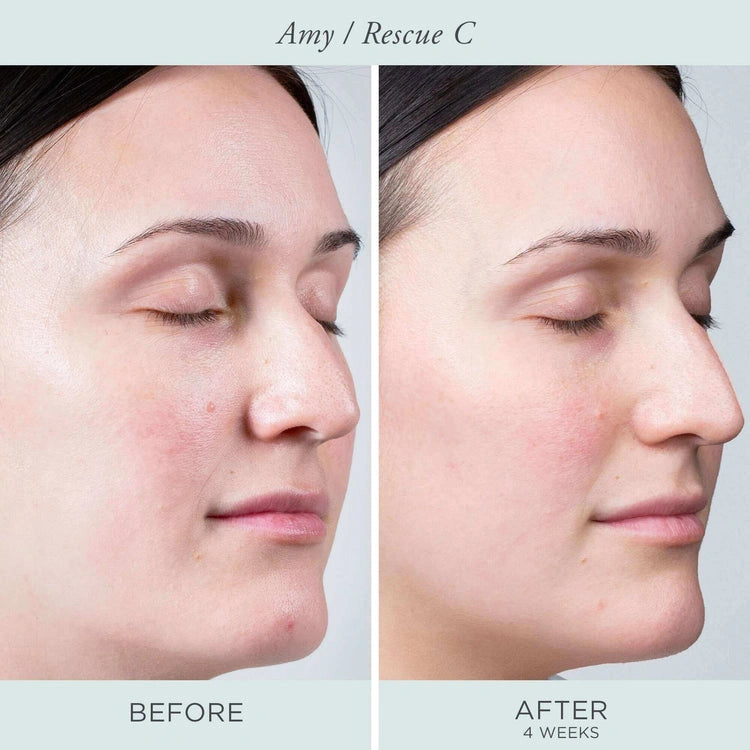 PUR Rescue C Brightening Vitamin C Peptide Eye Cream 15ml voor en na gebruik bij Amy, zichtbaar resultaat na 4 weken.